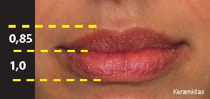 Χείλη Αισθησιακά  αναλογία άνω/κάτω  0,75 - 0,85 - 0,90