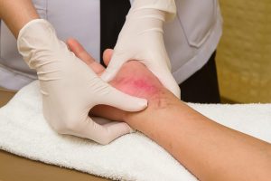 Ουλή και Επανορθωτική Χειρουργική: Θεραπείες που περιλαμβάνει