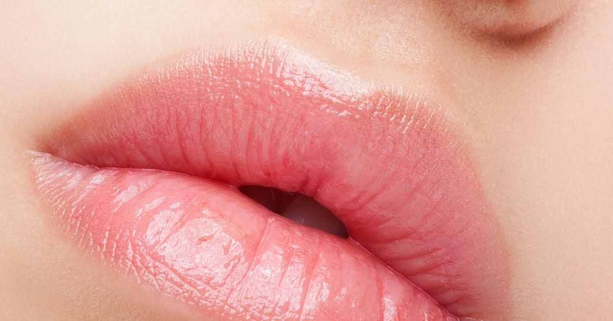 πλαστική στα χείλη lip lift 