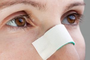 Πλαστική Χειρουργική στη μύτη: Τι να περιμένετε έπειτα από την επέμβαση