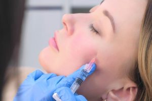 Υαλουρονικό οξύ στα μάγουλα: Τι είναι και πώς λειτουργεί