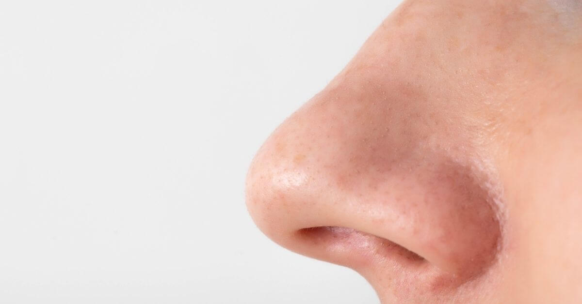 μύτη πλαστική δυσκολίες αναπνοής 