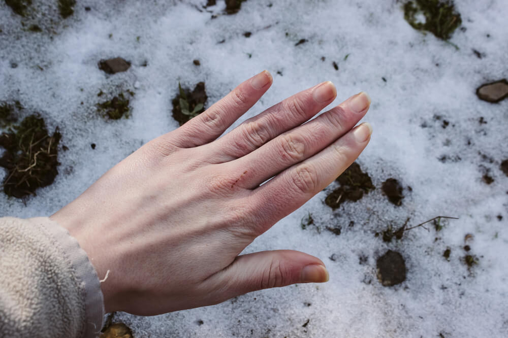 Ξηρά χέρια: 4+1 tips αντιμετώπισης τον χειμώνα