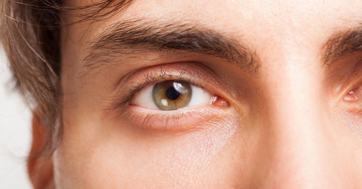 πλαστική χειρουργική για άντρες μάτια 