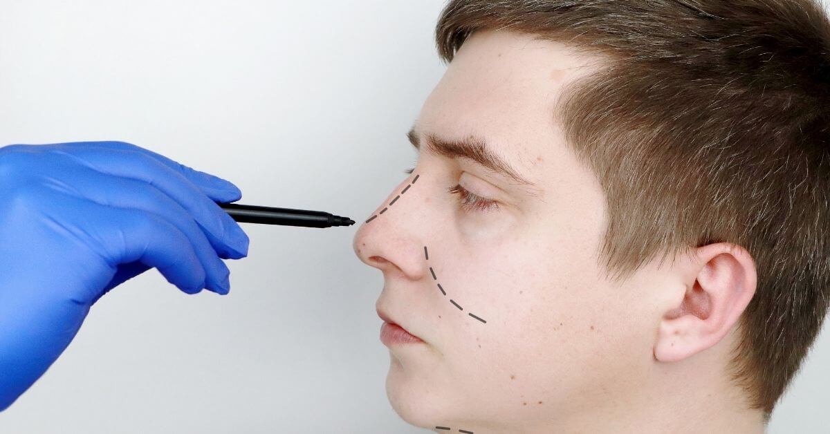 πλαστική χειρουργική για άντρες μύτη 