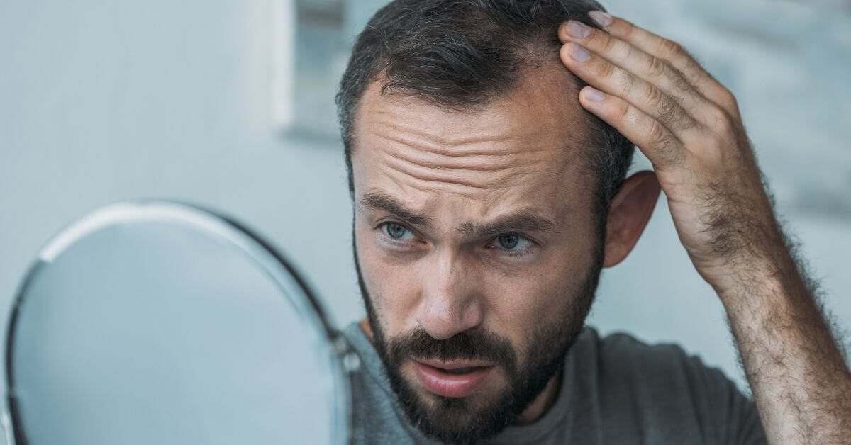 θεραπεία για τριχόπτωση μεταμόσχευση 